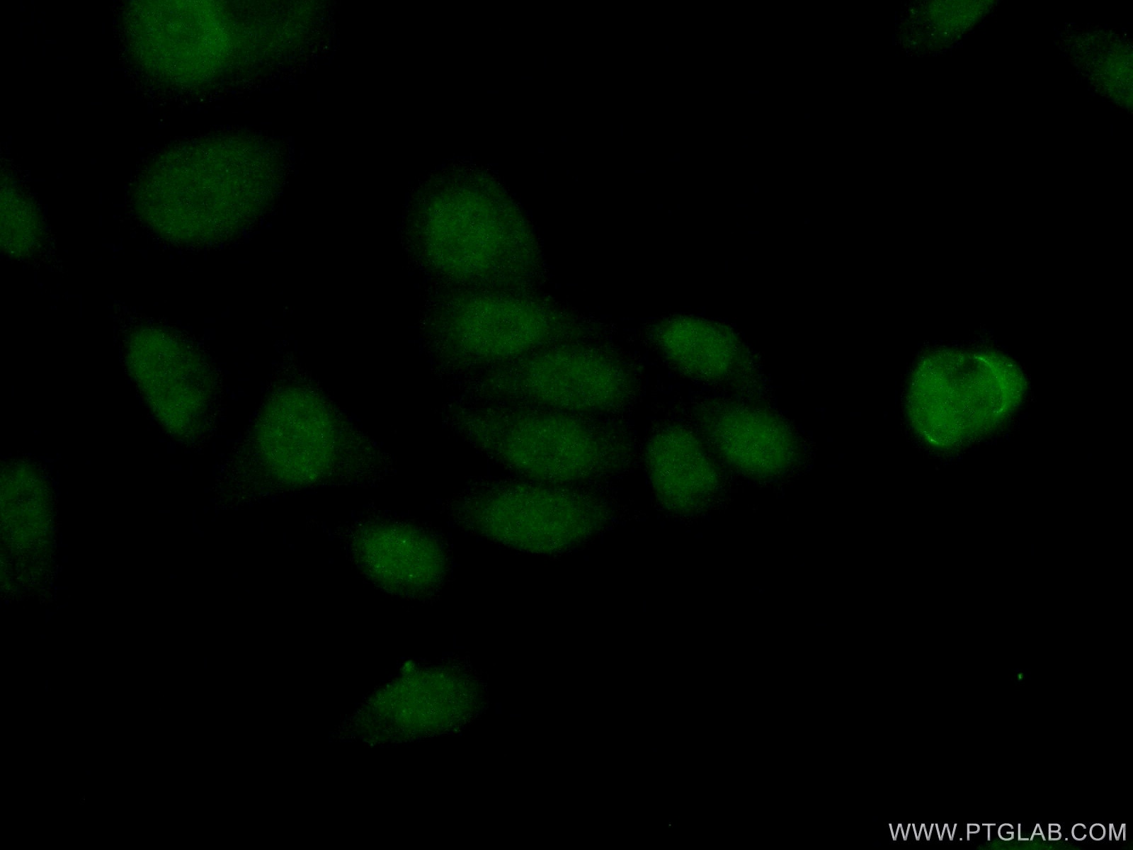 Immunofluorescence (IF) / fluorescent staining of HeLa cells using HDAC8 Polyclonal antibody (17548-1-AP)