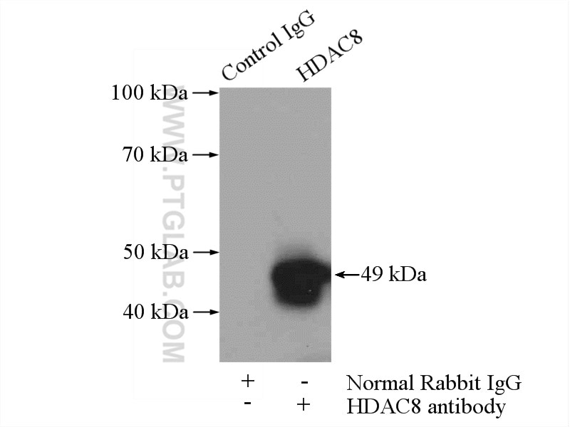 Immunoprecipitation (IP) experiment of Raji cells using HDAC8 Polyclonal antibody (17548-1-AP)