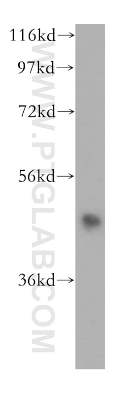 Western Blot (WB) analysis of HeLa cells using HDAC8 Polyclonal antibody (17548-1-AP)