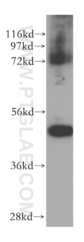 Western Blot (WB) analysis of Raji cells using HDAC8 Polyclonal antibody (17548-1-AP)