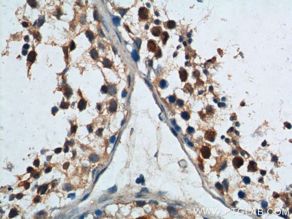 Immunohistochemistry (IHC) staining of human testis tissue using HDAC9 Polyclonal antibody (23328-1-AP)