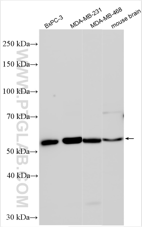 Western Blot (WB) analysis of various lysates using HDAC9 Polyclonal antibody (28334-1-AP)