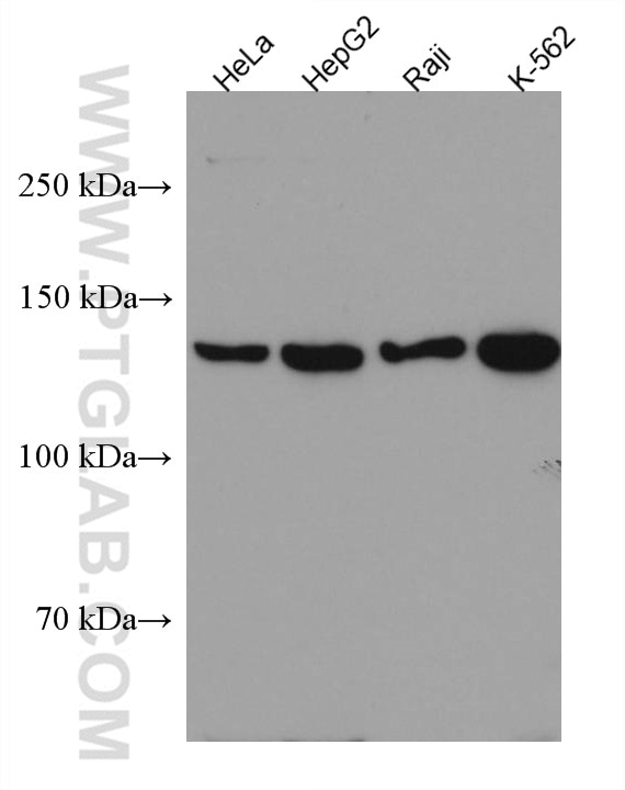 Western Blot (WB) analysis of various lysates using HDAC9 Monoclonal antibody (67364-1-Ig)