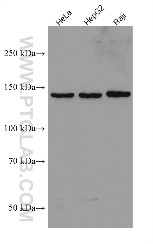 HDAC9