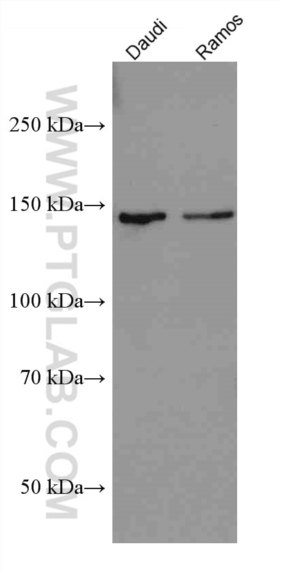 Western Blot (WB) analysis of various lysates using HDAC9 Monoclonal antibody (67364-1-Ig)