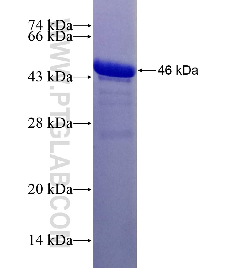 HDAC9 fusion protein Ag19930 SDS-PAGE