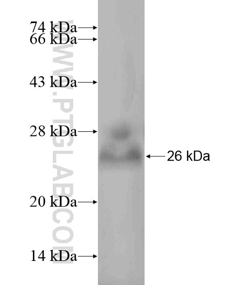 HDAC9 fusion protein Ag19947 SDS-PAGE