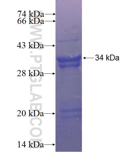 HDC fusion protein Ag23188 SDS-PAGE