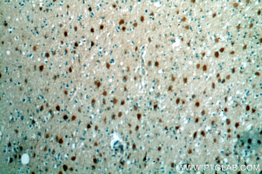 Immunohistochemistry (IHC) staining of human brain tissue using HDDC2 Polyclonal antibody (16632-1-AP)