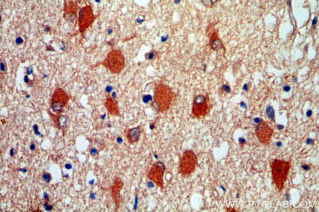 Immunohistochemistry (IHC) staining of human brain tissue using HDDC2 Polyclonal antibody (16632-1-AP)