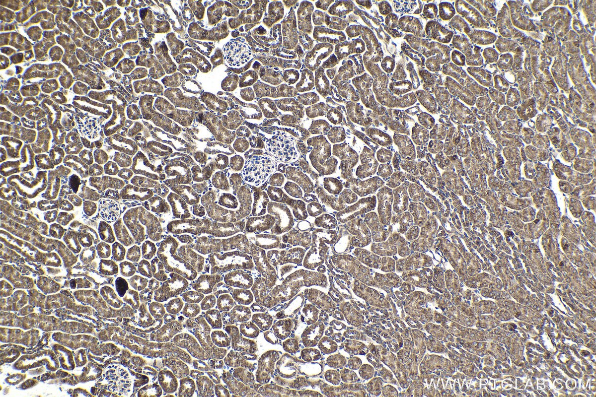 Immunohistochemistry (IHC) staining of mouse kidney tissue using HDDC2 Monoclonal antibody (68391-1-Ig)