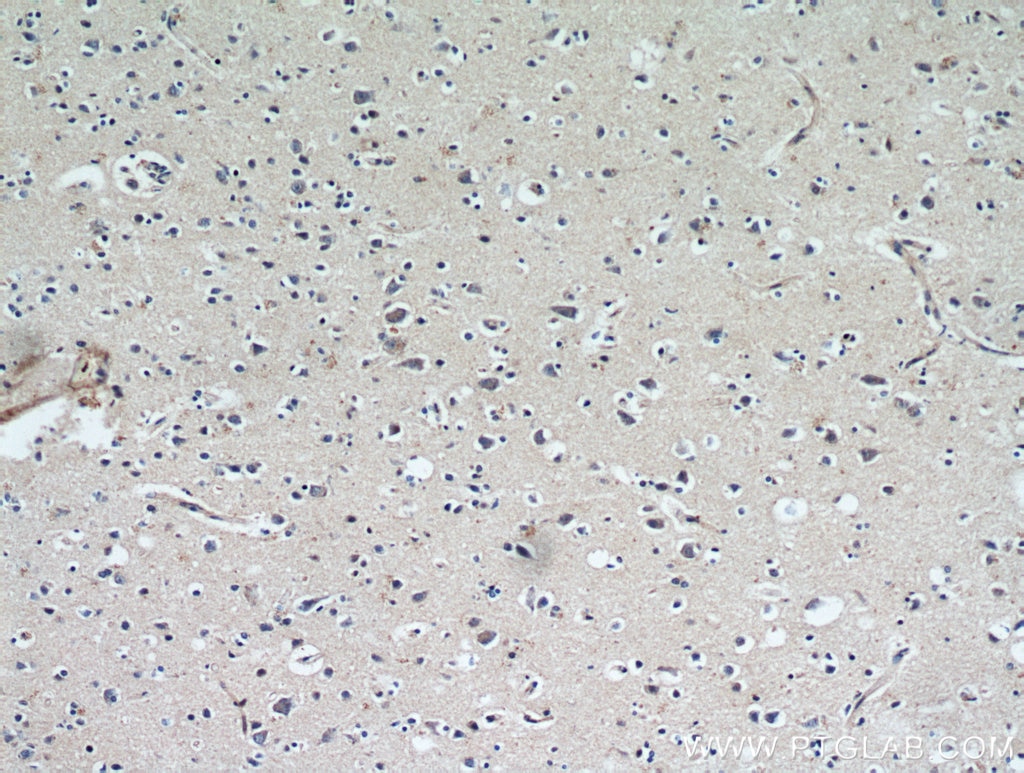 Immunohistochemistry (IHC) staining of human brain tissue using HDDC3 Polyclonal antibody (21091-1-AP)