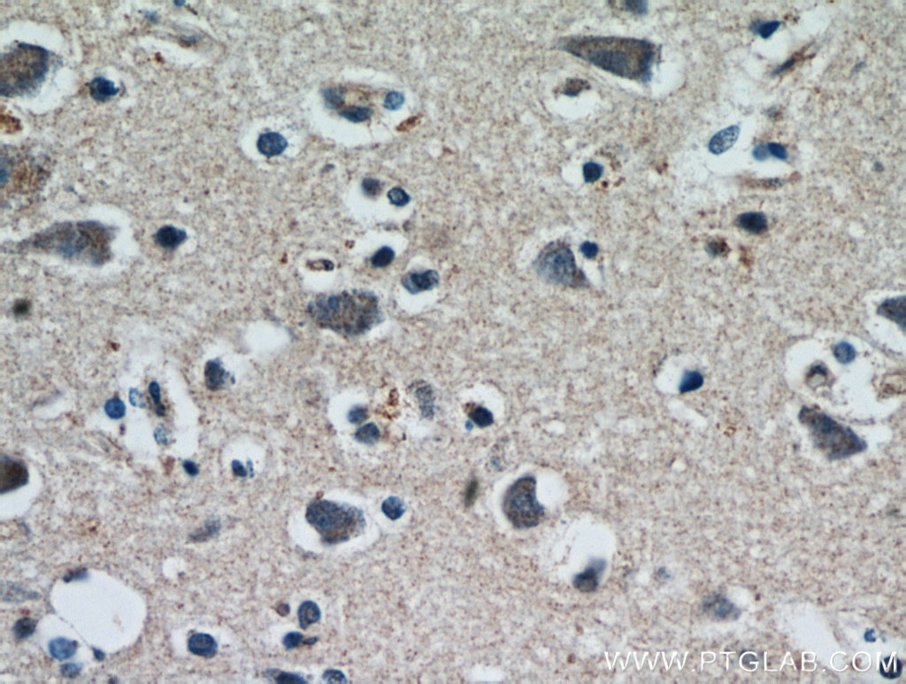 Immunohistochemistry (IHC) staining of human brain tissue using HDDC3 Polyclonal antibody (21091-1-AP)