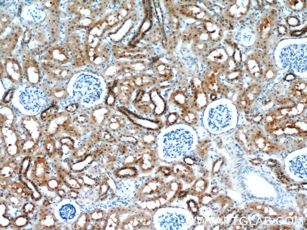 Immunohistochemistry (IHC) staining of human kidney tissue using HDDC3 Polyclonal antibody (21091-1-AP)