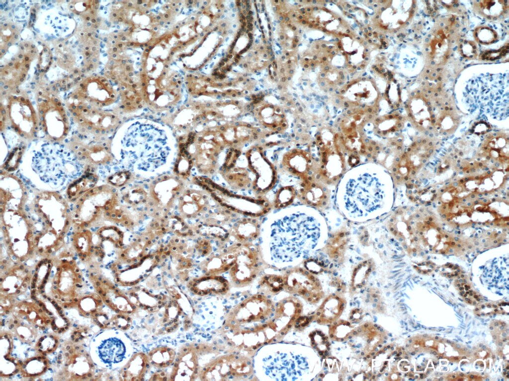 Immunohistochemistry (IHC) staining of human kidney tissue using HDDC3 Polyclonal antibody (21091-1-AP)