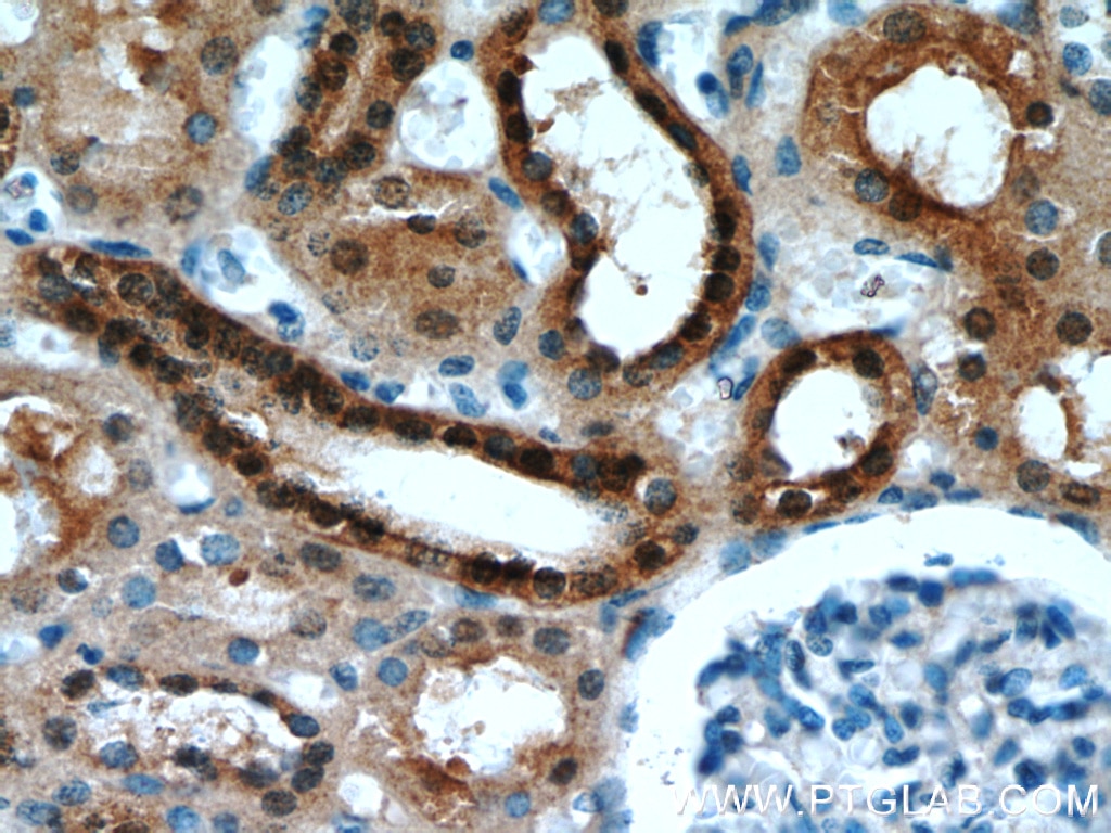 Immunohistochemistry (IHC) staining of human kidney tissue using HDDC3 Polyclonal antibody (21091-1-AP)