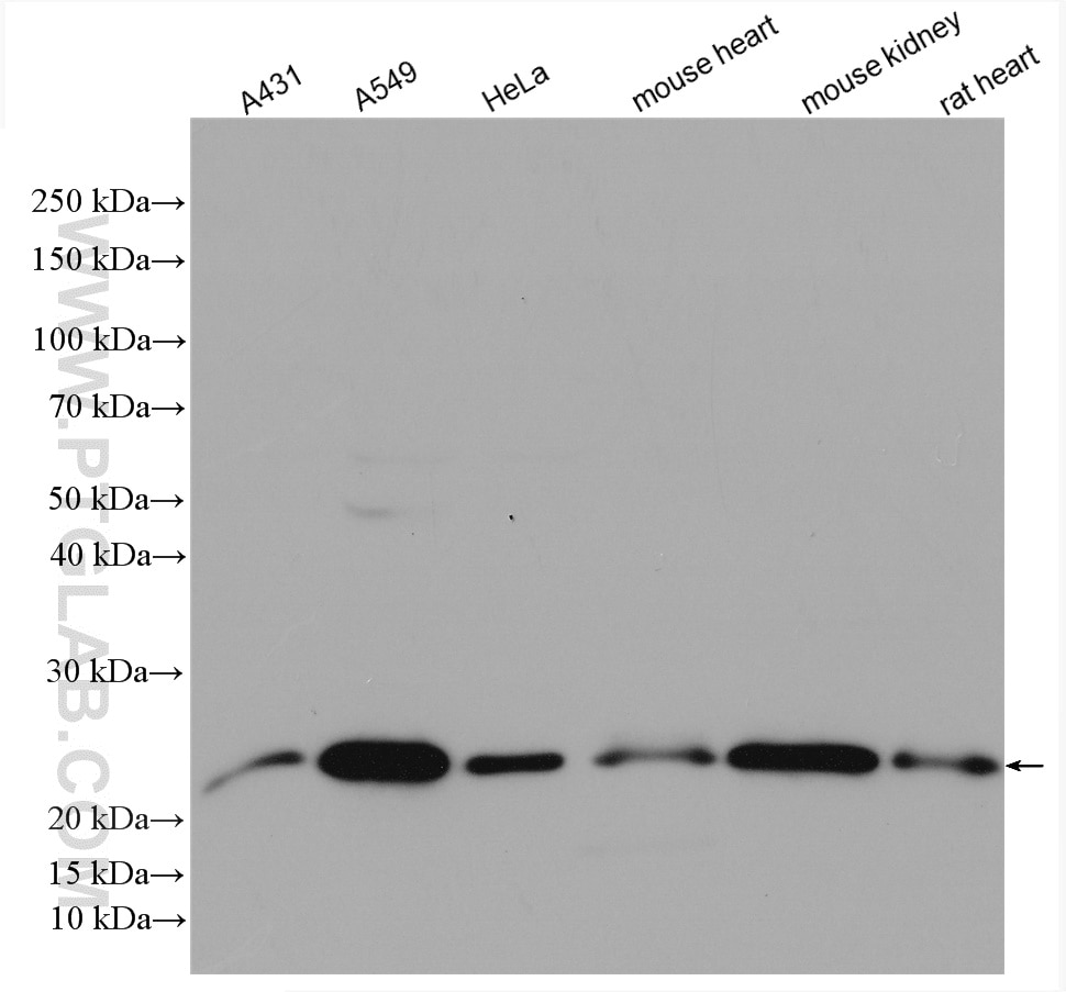 Western Blot (WB) analysis of various lysates using HDDC3 Polyclonal antibody (21091-1-AP)