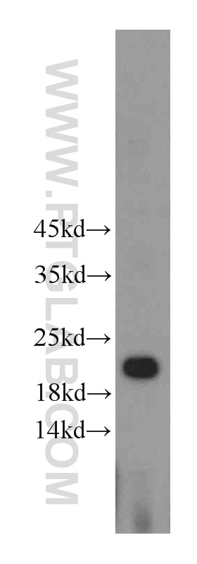 Western Blot (WB) analysis of HeLa cells using HDDC3 Polyclonal antibody (21091-1-AP)