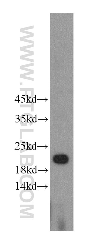 WB analysis of HeLa using 21091-1-AP