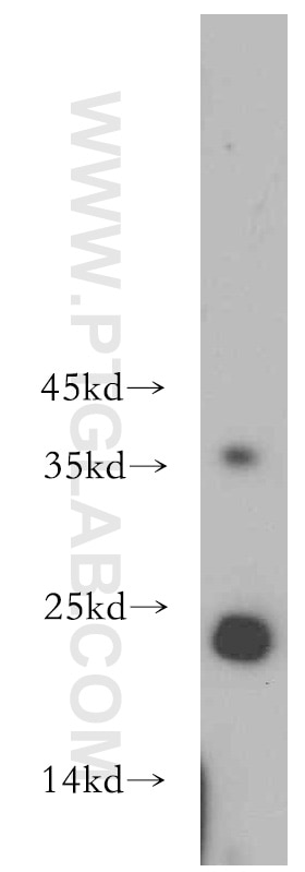 Western Blot (WB) analysis of mouse pancreas tissue using HDDC3 Polyclonal antibody (21091-1-AP)