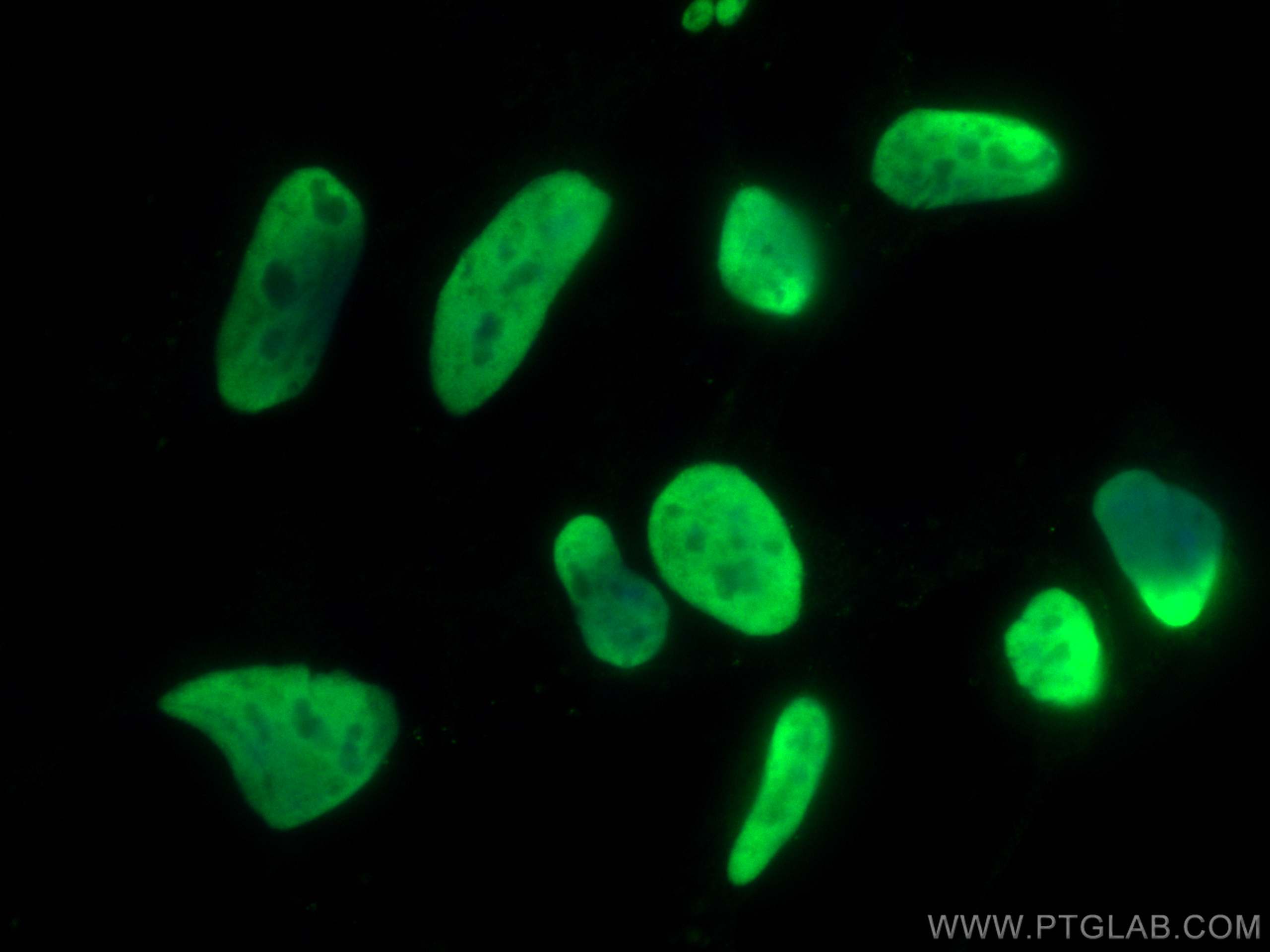 Immunofluorescence (IF) / fluorescent staining of HEK-293 cells using HDGF Polyclonal antibody (11344-1-AP)