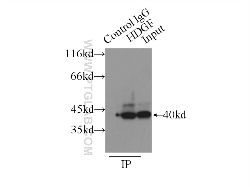 Immunoprecipitation (IP) experiment of HepG2 cells using HDGF Polyclonal antibody (11344-1-AP)