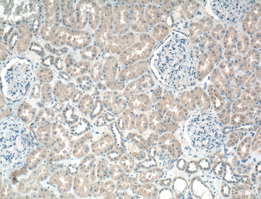 Immunohistochemistry (IHC) staining of human kidney tissue using HDGF Monoclonal antibody (60064-1-Ig)
