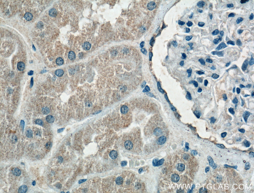 Immunohistochemistry (IHC) staining of human kidney tissue using HDGF Monoclonal antibody (60064-1-Ig)