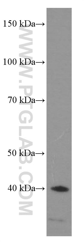 Western Blot (WB) analysis of A549 cells using HDGF Monoclonal antibody (60064-1-Ig)