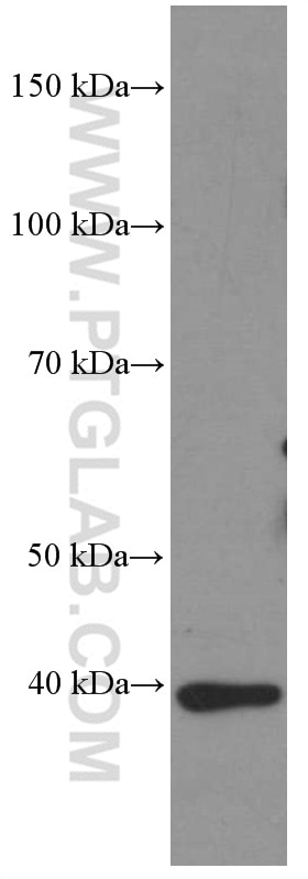 Western Blot (WB) analysis of rat liver tissue using HDGF Monoclonal antibody (60064-1-Ig)