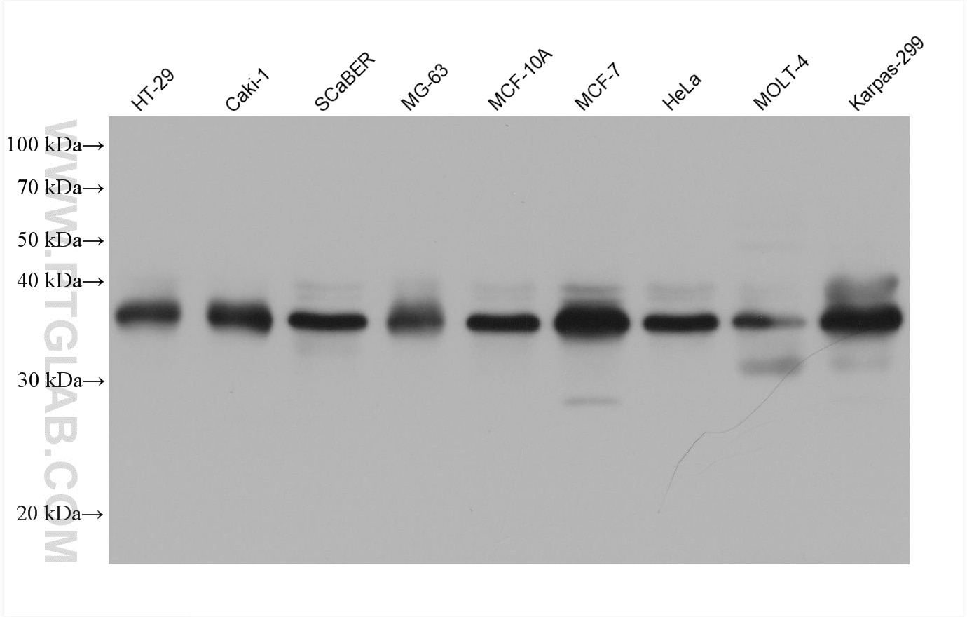 WB analysis using 60064-2-Ig (same clone as 60064-2-PBS) Western Blot (WB) analysis of various lysates using HDGF Monoclonal antibody (60064-2-Ig)