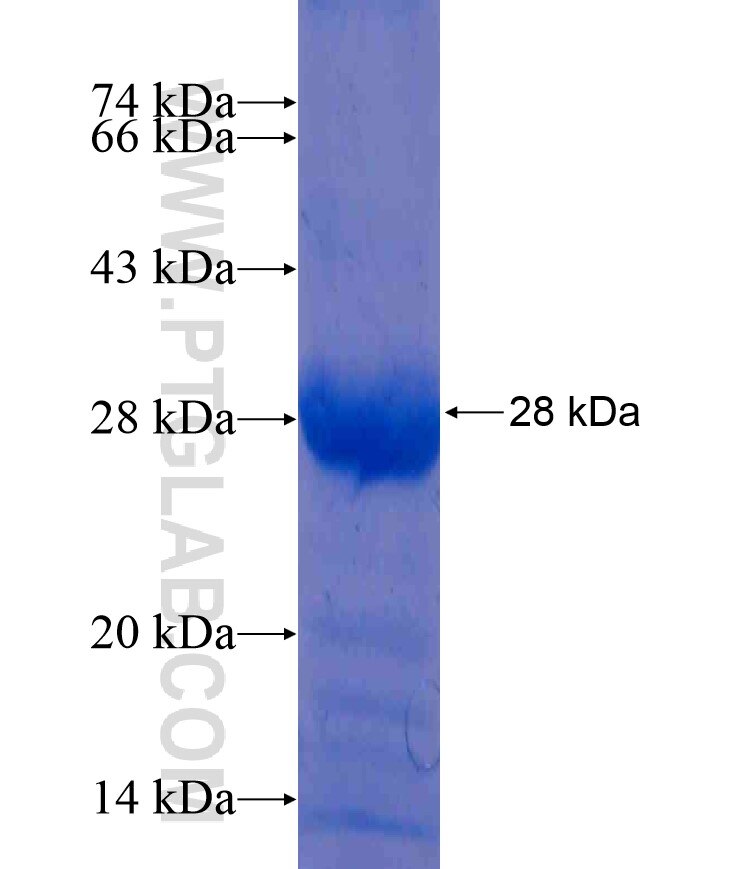 HDGF fusion protein Ag17090 SDS-PAGE