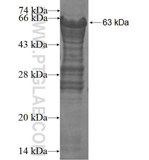 HDGF fusion protein Ag1893 SDS-PAGE