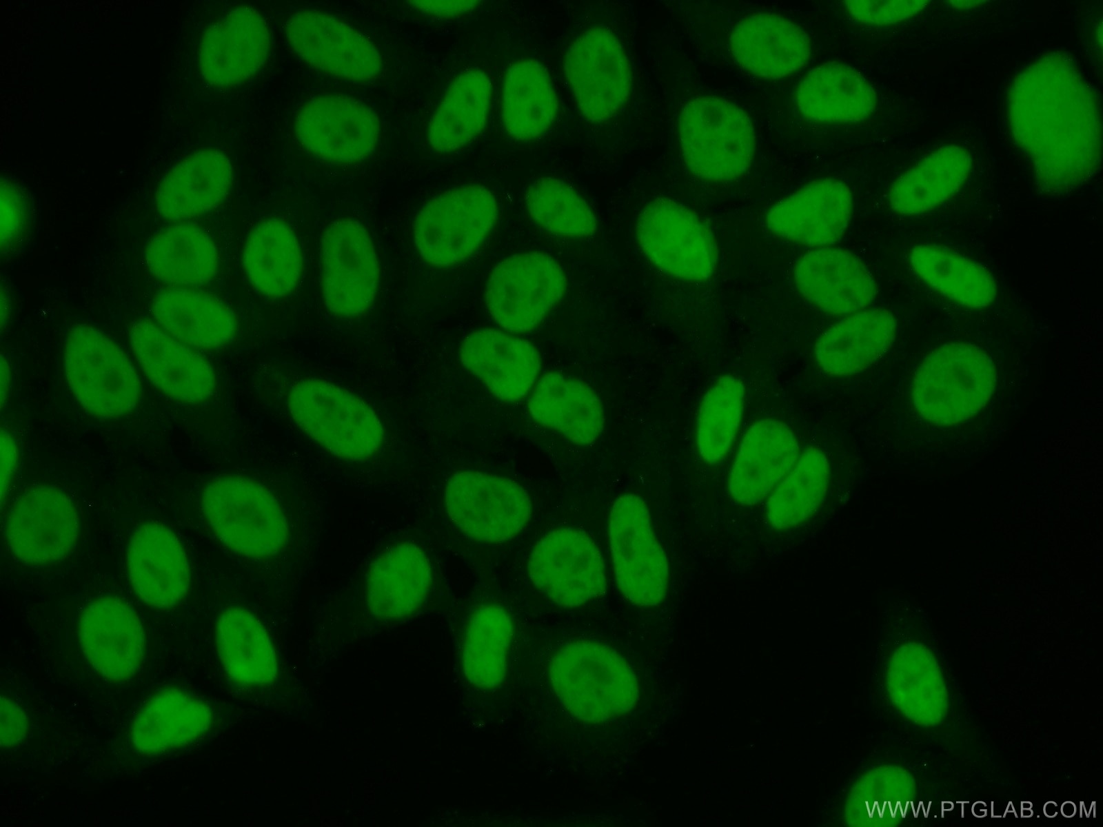 Immunofluorescence (IF) / fluorescent staining of HepG2 cells using HDGF2 Polyclonal antibody (15134-1-AP)