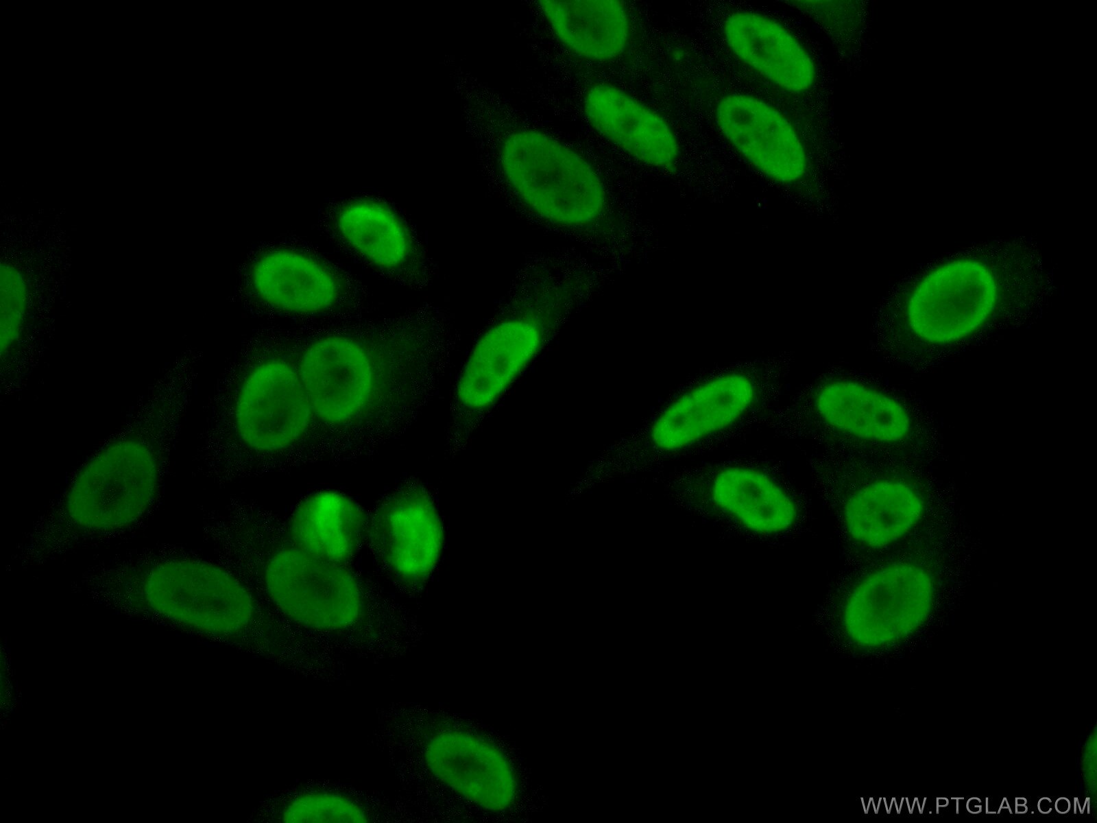 Immunofluorescence (IF) / fluorescent staining of HepG2 cells using HDGF2 Polyclonal antibody (15134-1-AP)