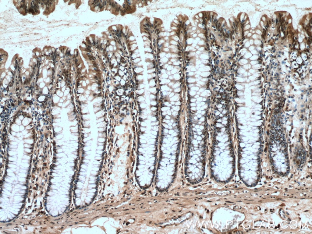 Immunohistochemistry (IHC) staining of human colon tissue using HDGF2 Polyclonal antibody (15134-1-AP)