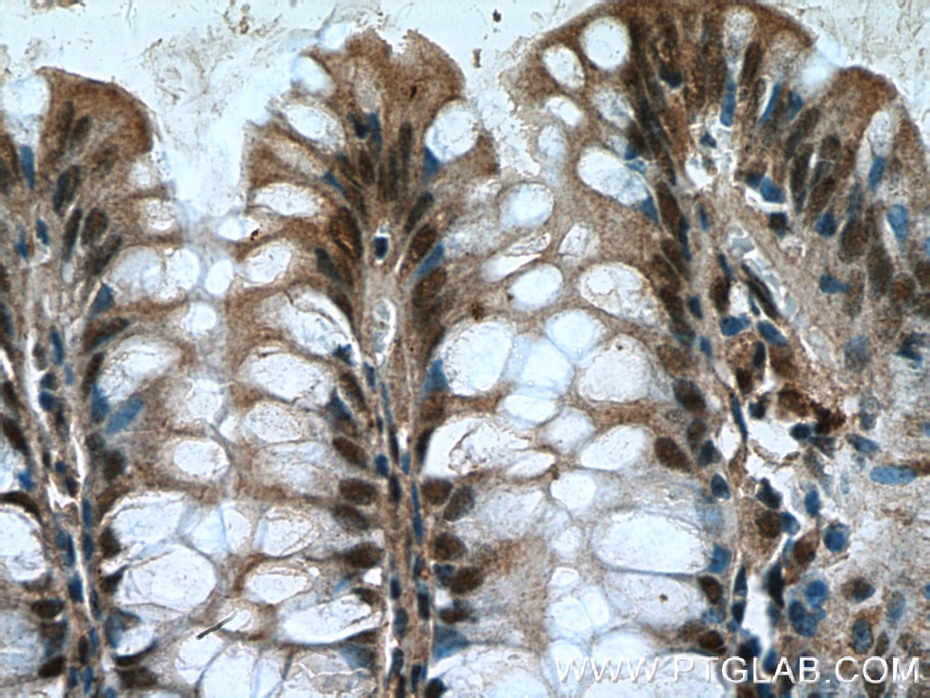 Immunohistochemistry (IHC) staining of human colon tissue using HDGF2 Polyclonal antibody (15134-1-AP)