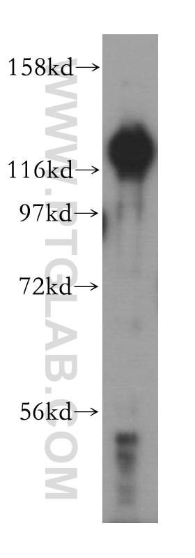 HDGF2 Polyclonal antibody
