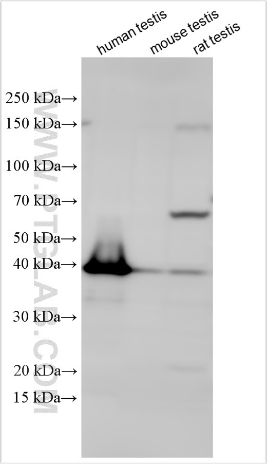 HDGFL1