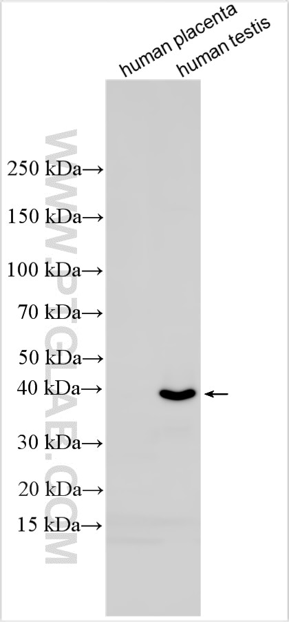 Western Blot (WB) analysis of various lysates using HDGFL1 Polyclonal antibody (31923-1-AP)