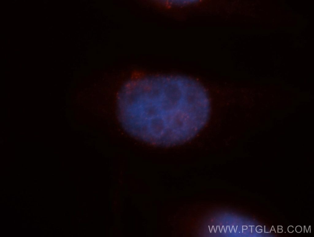 Immunofluorescence (IF) / fluorescent staining of MCF-7 cells using HDGFRP3 Polyclonal antibody (12380-1-AP)