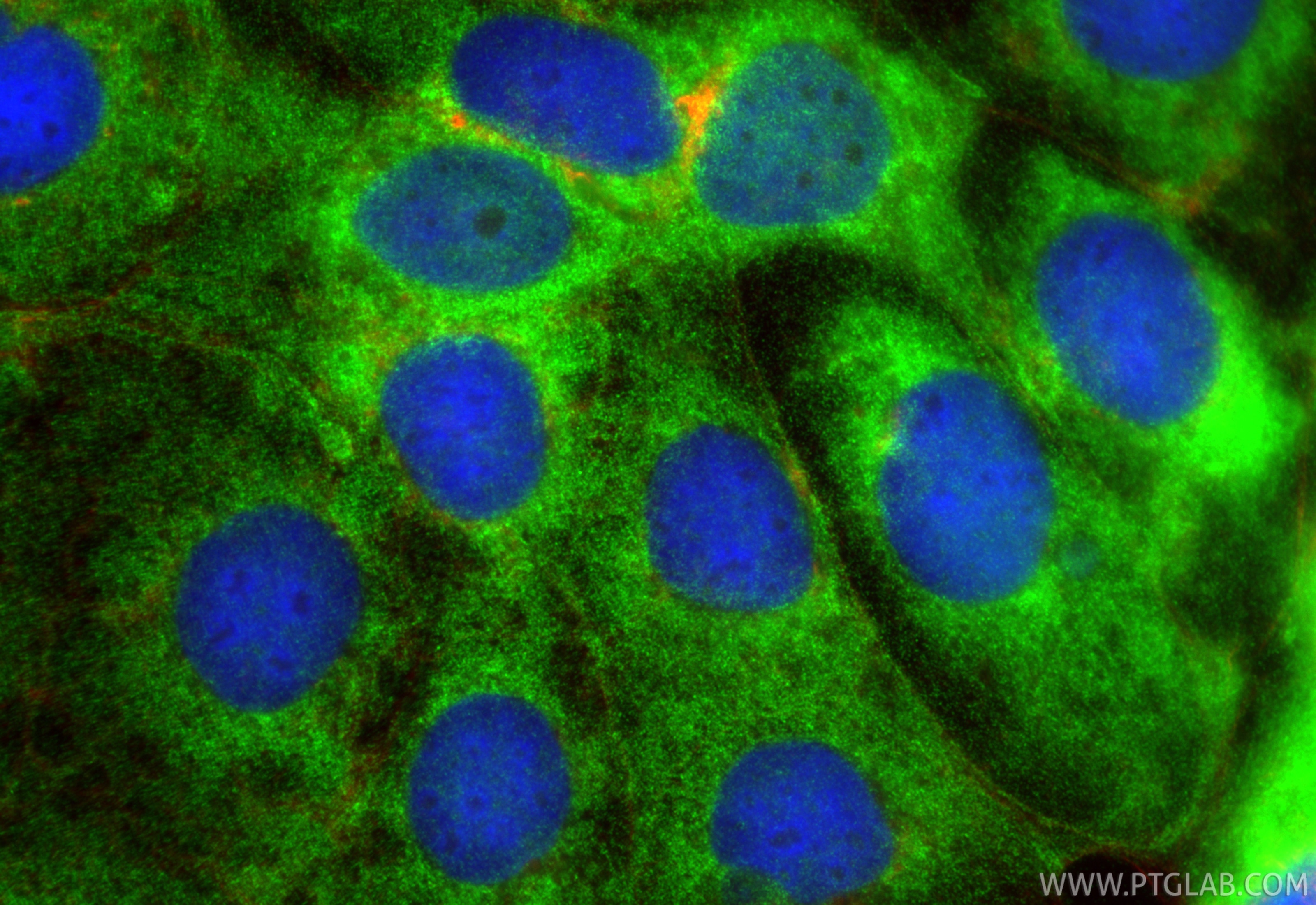 Immunofluorescent analysis of (-20°C Ethanol) fixed Caco-2 cells using HDHD1A antibody (33953-1-AP) at dilution of 1:400 and CoraLite®488-Conjugated Goat Anti-Rabbit IgG(H+L) (SA00013-2), CL594-Phalloidin (red). Immunofluorescence (IF) / fluorescent staining of Caco-2 cells using HDHD1A Polyclonal antibody (33953-1-AP)