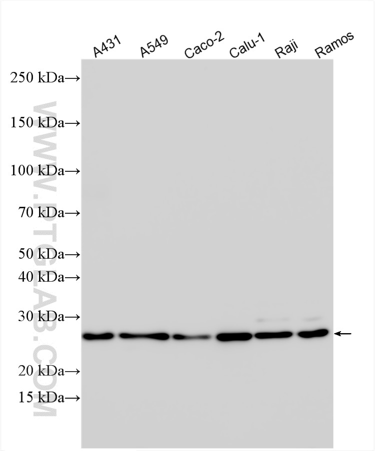 Various lysates were subjected to SDS PAGE followed by western blot with 33953-1-AP (HDHD1A antibody) at dilution of 1:4000 incubated at room temperature for 1.5 hours. Western Blot (WB) analysis of various lysates using HDHD1A Polyclonal antibody (33953-1-AP)