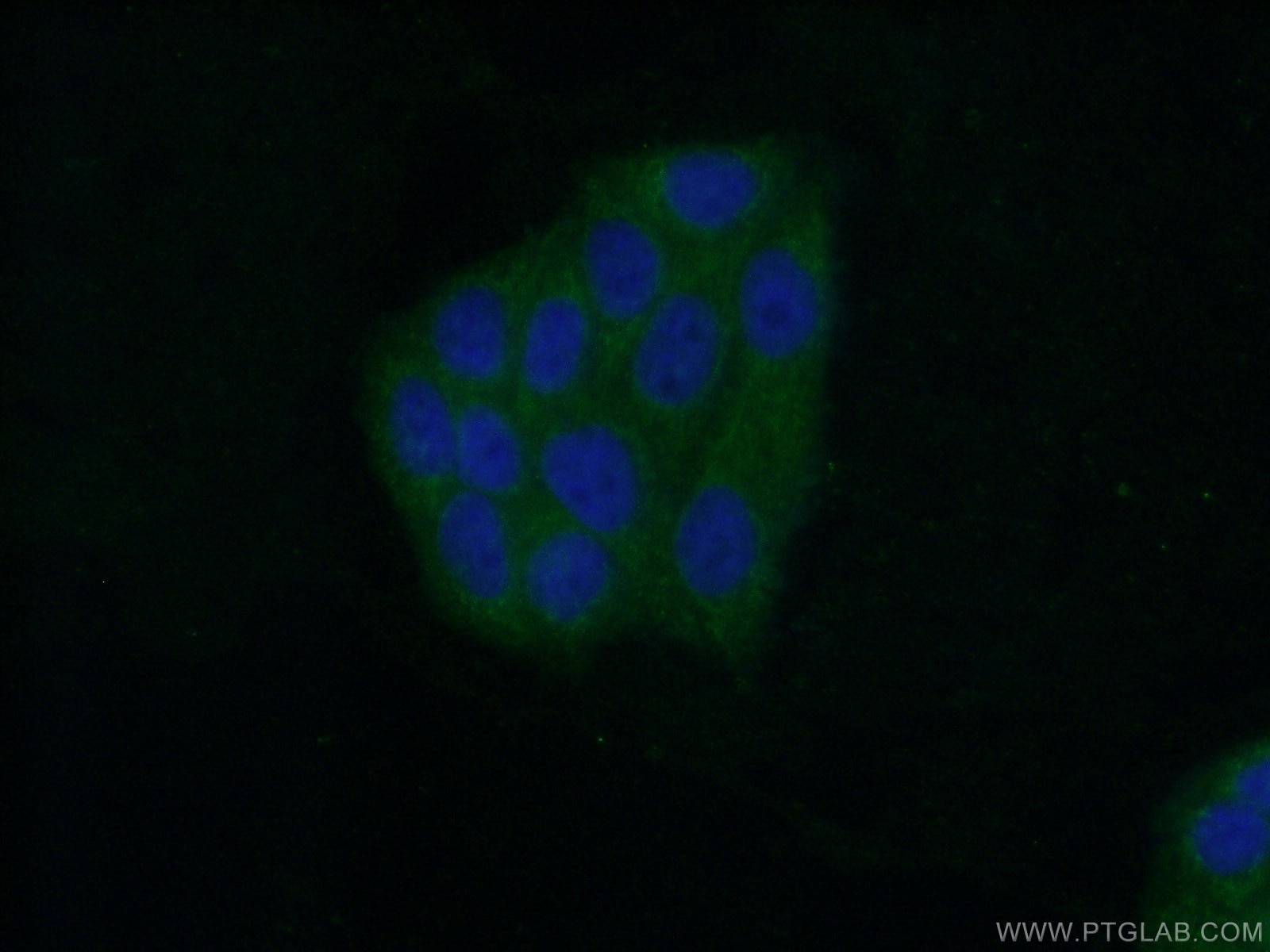 Immunofluorescence (IF) / fluorescent staining of HepG2 cells using HDHD2 Polyclonal antibody (26147-1-AP)