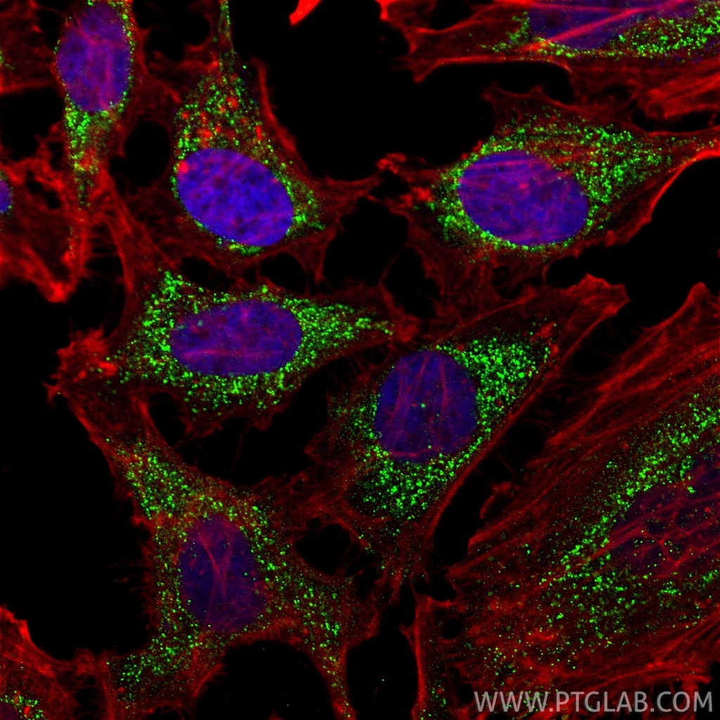 Immunofluorescence (IF) / fluorescent staining of HeLa cells using HDHD2 Polyclonal antibody (26147-1-AP)