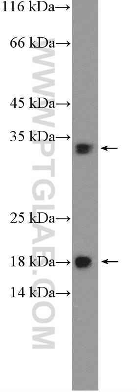 Western Blot (WB) analysis of HepG2 cells using HDHD2 Polyclonal antibody (26147-1-AP)