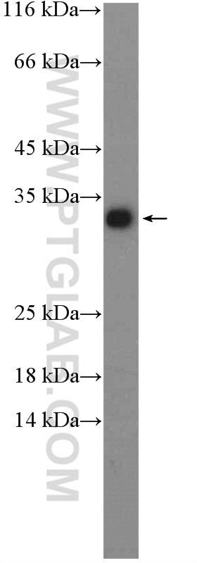 Western Blot (WB) analysis of mouse liver tissue using HDHD2 Polyclonal antibody (26147-1-AP)