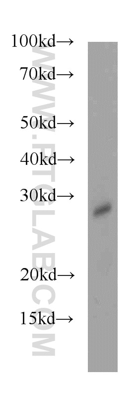 Western Blot (WB) analysis of mouse small intestine tissue using HDHD3 Polyclonal antibody (20821-1-AP)
