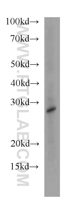 Western Blot (WB) analysis of mouse colon tissue using HDHD3 Polyclonal antibody (20821-1-AP)