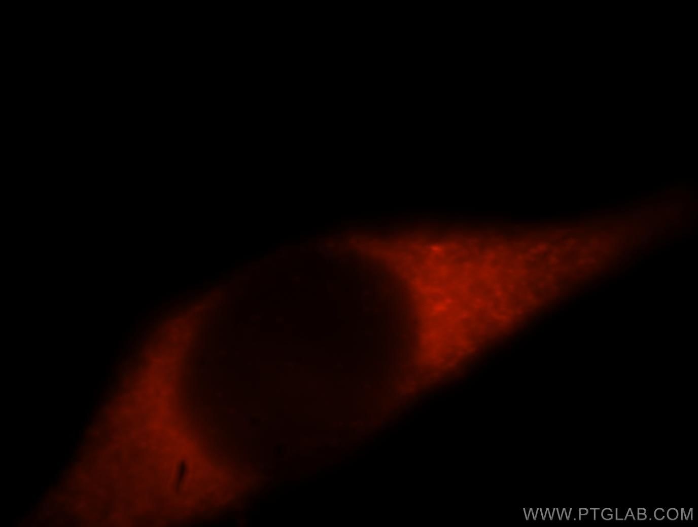 Immunofluorescence (IF) / fluorescent staining of MCF-7 cells using HDLBP Polyclonal antibody (15406-1-AP)